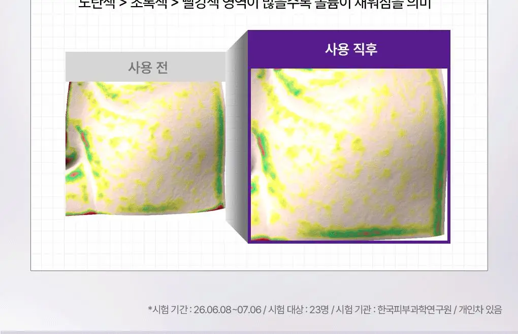 [업그레이드 모공탄력세럼] 메디힐 PDRN 더마 세럼 50+50mL 기획 상세페이지 17